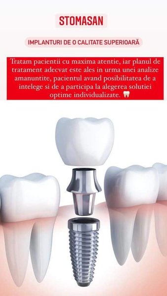 Stomasan - Clinica stomatologica